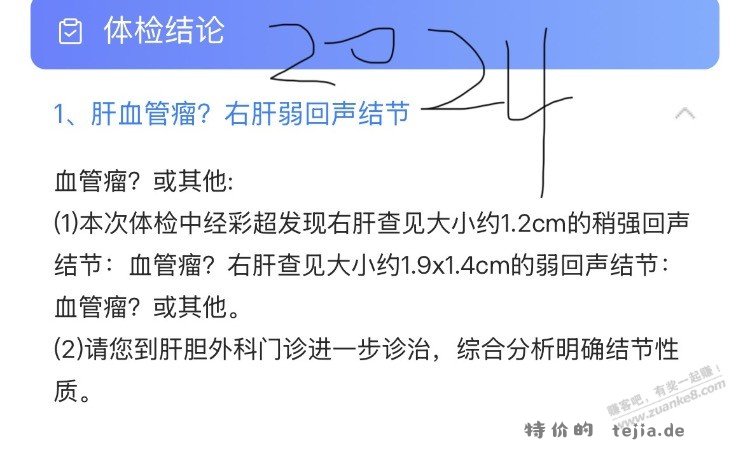 有gemini的帮我问问ai体检报告 - 特价的
