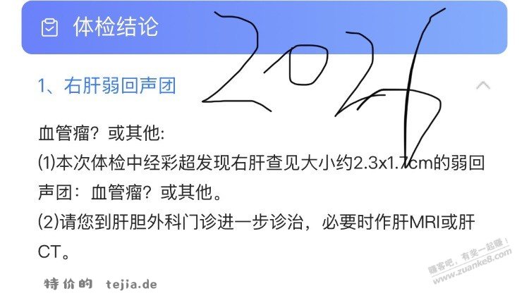 有gemini的帮我问问ai体检报告 - 特价的