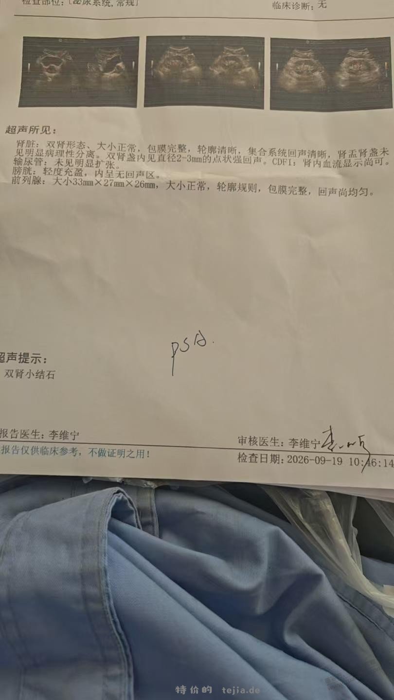 医生让我做psa，好担心！！！ - 特价的